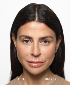 Instant Eye Tightener Instant Eye Tightener